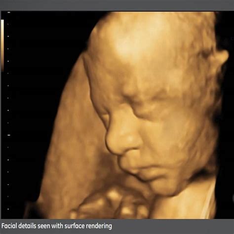 GE Ultrasound Scanner - GE Voluson E8 BT16 Ultrasound Scanner Trader ...