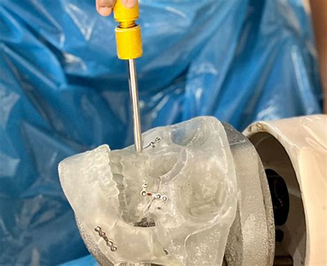 Oral and Maxillofacial Surgery | Yenepoya Dental College in Mangalore