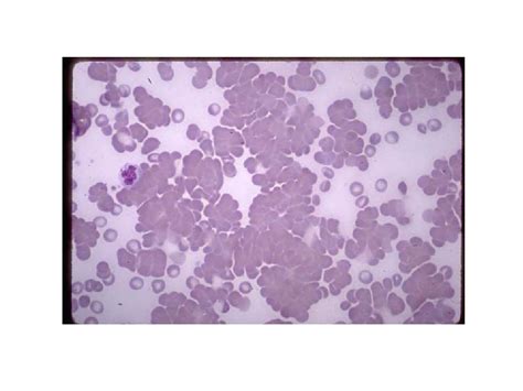 Image result for Retics Count by Flow Cytometry