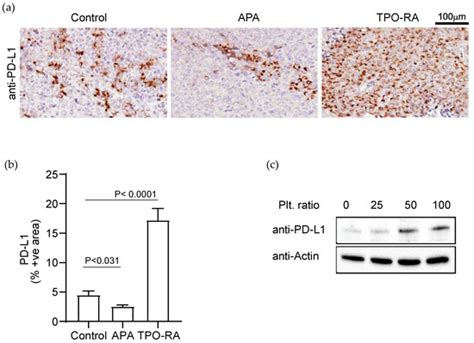 Cancers | Special Issue : Cell Stress, Metabolism, Tumor ...