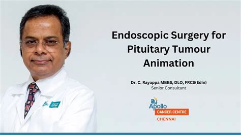 Endoscopic Pituitary Surgery | Head and Neck Surgery