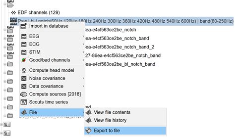 Image result for Convert EDF File to MAT-file