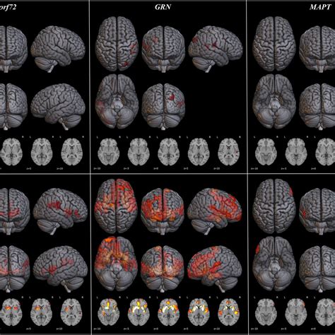 Image result for Variant Form