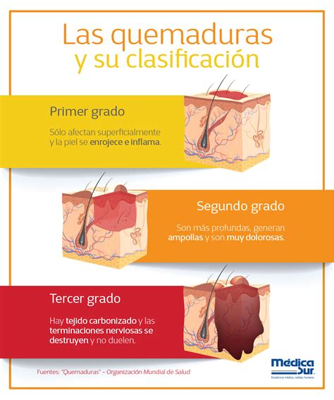 Quemaduras De Segundo Grado Tratadas Con Hialucic Blog Calaméo ...