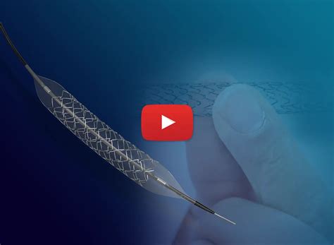 Laser Cutting Machine Manufacturer India- SLTL Group®