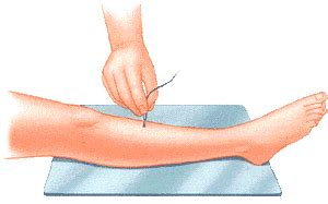 Image result for EMG Back Test