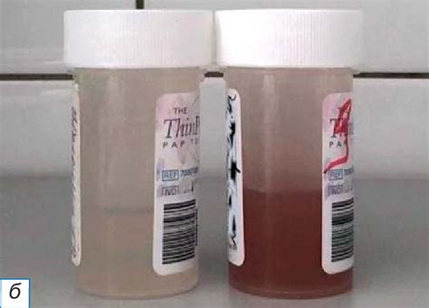 Image result for Visual Test Product Assessment Sample