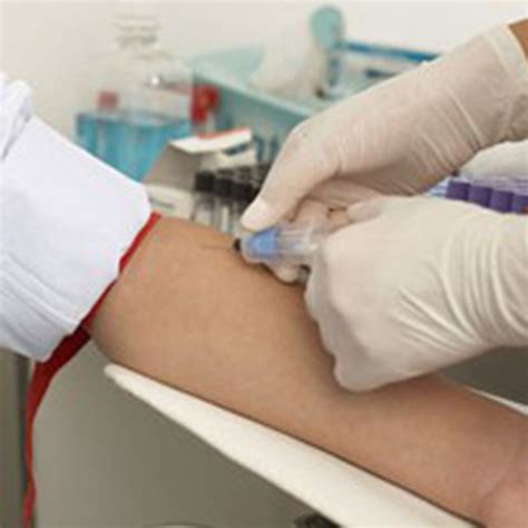 What do we mean by fasting blood glucose test? | Dr. Suman Kirti