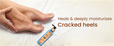 Buy Blue Nectar Ultra Hydrating Warm Vanilla Body Lotion for Dry Skin ...