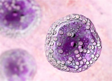 30 Facts About Burkitt Lymphoma (Non-Hodgkin Lymphoma) - Facts.net