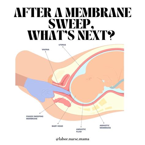 Whats A Membrane Sweep