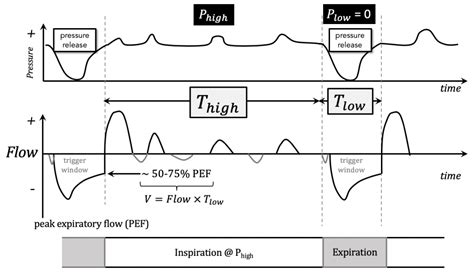 Aprv Algorithm Chart 的图像结果