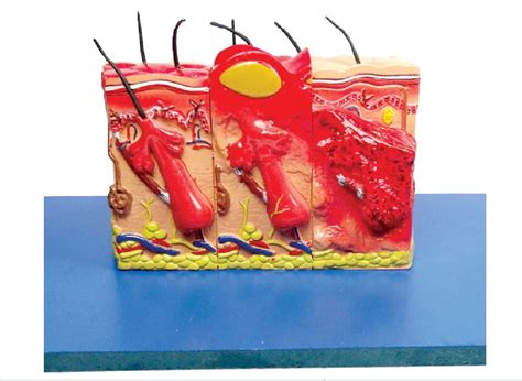 ZX | Skin Burn Model | HSP Resin | 20 features marked | Anatomical ...