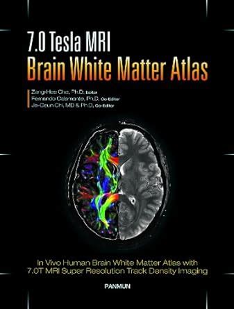 Amazon.in: Buy 7.0 Tesla MRI Brain White Matter Atlas: 1 Book Online at ...