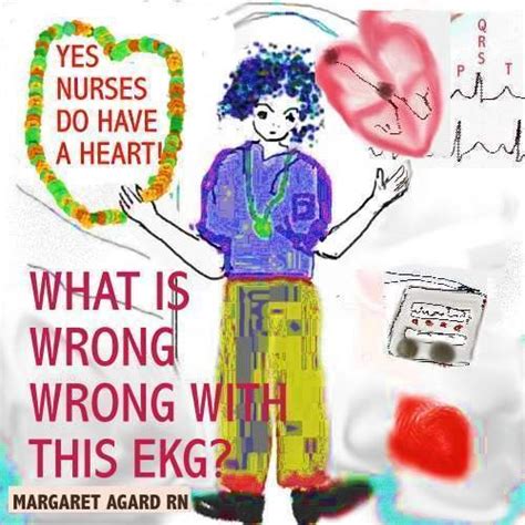 EKG Series Part 1 What is Wrong with this EKG eBook : Agard, Margaret ...