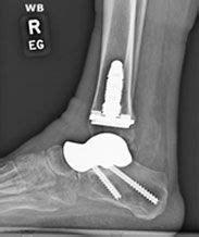 Hardware Monitor Driver 的图像结果