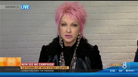 Catching up with singer Cyndi Lauper, the face of psoriasis 'See Me ...