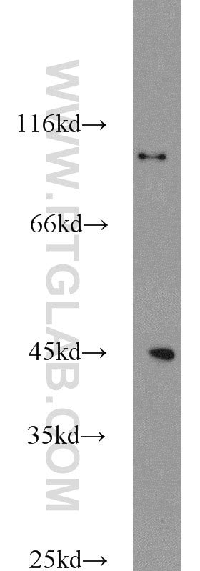 Cyclin H antibody (10718-1-AP) | Proteintech