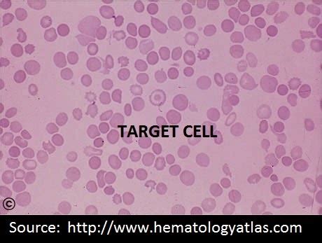 Image result for Target Cells