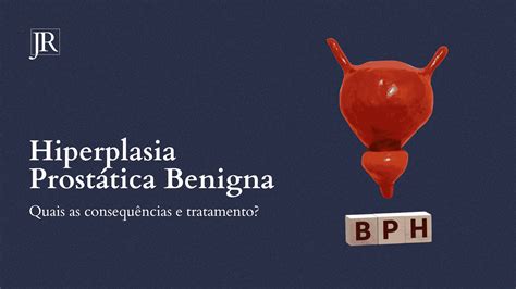 Tratamento da Hiperplasia Prostática Benigna: saiba quais são!