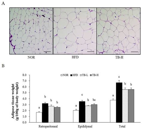 Tartary Buckwheat Extract Attenuated the Obesity-Induced Inflammation ...