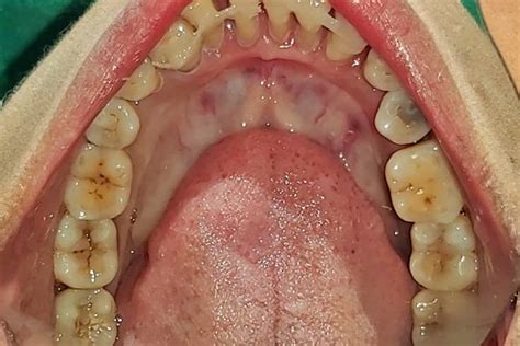 KIMS | Periodontics