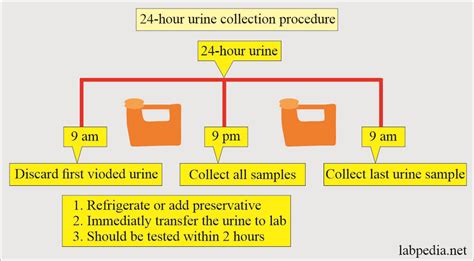 Image result for Urine Collection Method