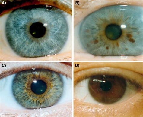 Image result for Iris Recognition Using MATLAB Source Code