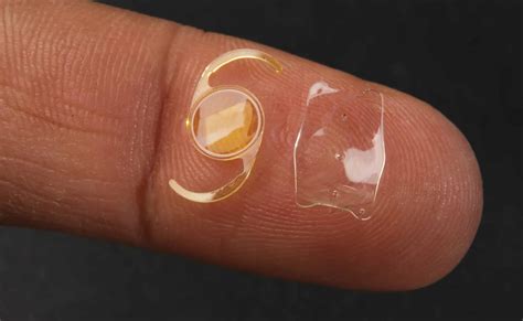 Implantable Collamer Lens (ICL): A Comprehensive Guide