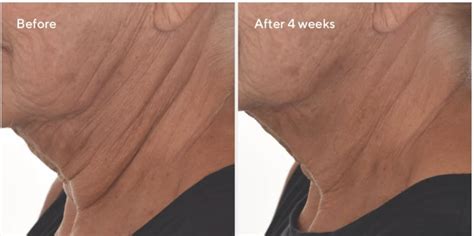 Murad Retinal Resculpt Treatment Reviews