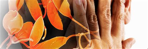 Image result for Big Exploding Infections