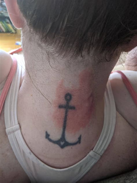 Image result for Moth Rash