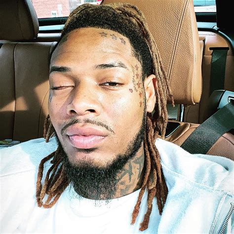 What happened to Fetty Wap's eye? | The US Sun
