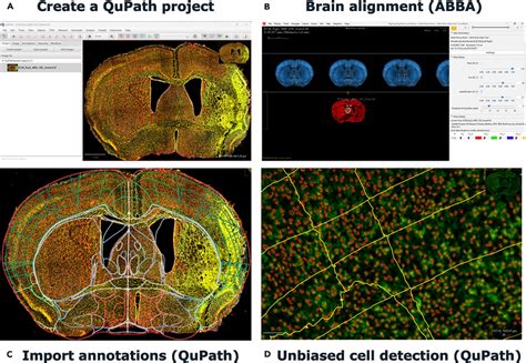 Image result for QuPath Basics