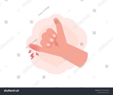 How to Tell If Your Finger Is Sprained: Quick Signs & DIY Relief ...