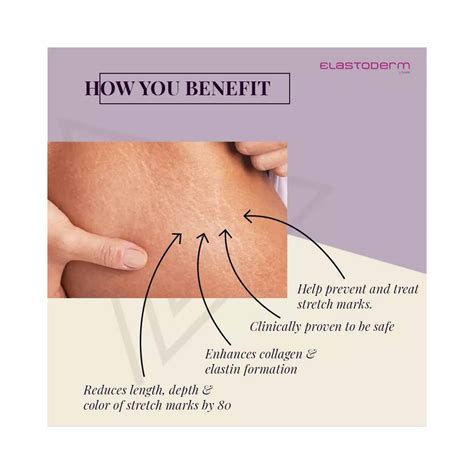Elastoderm Stretch Mark and Skin Firming Cream 50g - Cureka