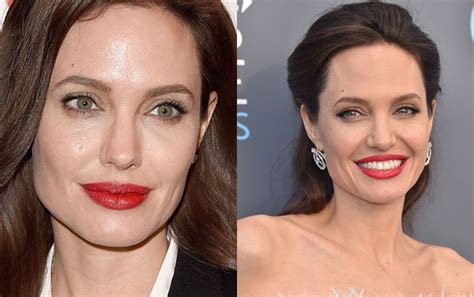 Meaning of Mole on the Forehead in Astrology