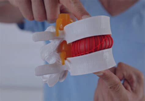 Image result for Flexion-Distraction vs Decompression