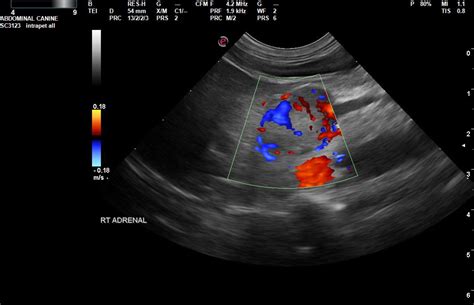 Bilateral adrenal gland masses with phrenic vein invasion in a 12 year old FS Bichon Frise - Members