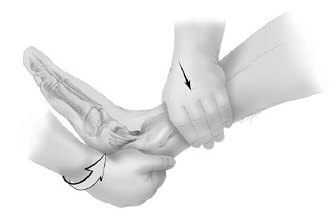 Anterior Drawer Test Ankle - WikiSM (Sports Medicine Wiki)