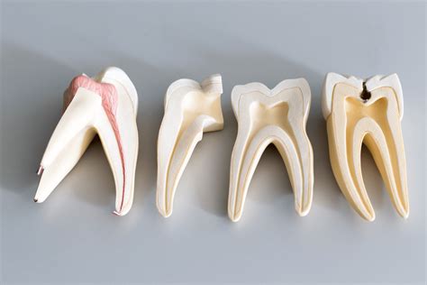 Simply: Root Canals. Do Root Canals Hurt? Root Canal Surgery.