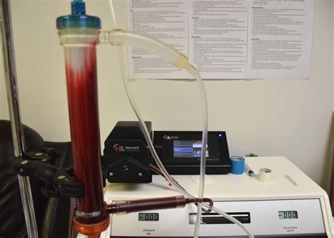 How Much Does EBOO Ozone Therapy Cost