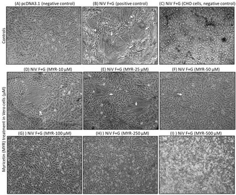 Myricetin Restricts the Syncytial Development Triggered by Nipah Virus ...