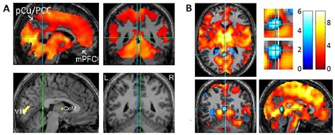 Rapid Eye Movements in Sleep Furnish a Unique Probe into the ...