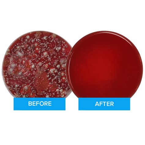 How Dirty is Your Phone? – PhoneSoap India