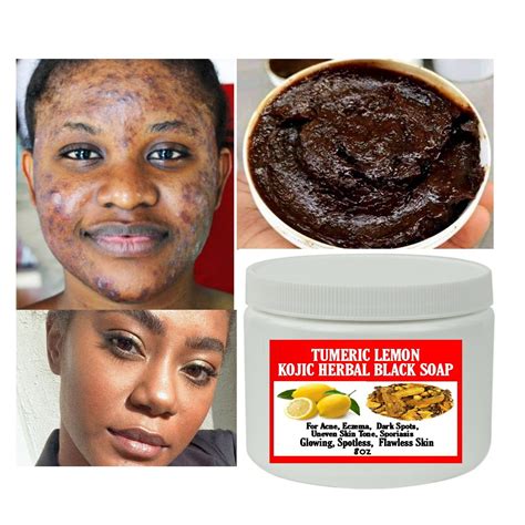 Tumeric Kojic Black soap, Herbal black soap, Acne Soap, Spots Free Skin, Even Skin ,Smooth skin ...