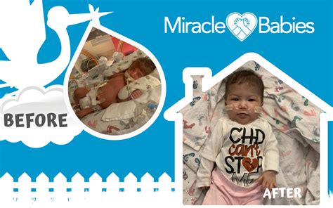 Miracle Baby Camila – Miracle Babies