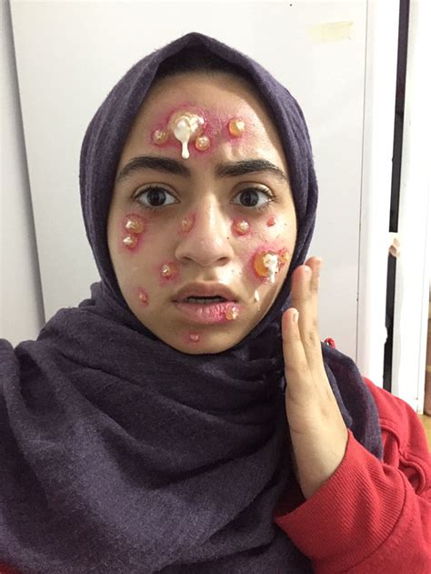 Image result for Tutorial FX Makeup