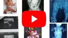 Best Academic Programs | Rainbow Children's Hospital