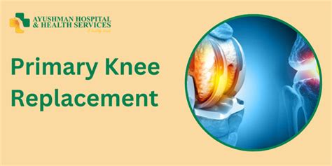 Primary Knee Replacement in Dwarka, Delhi by Dr. Raj Kumar